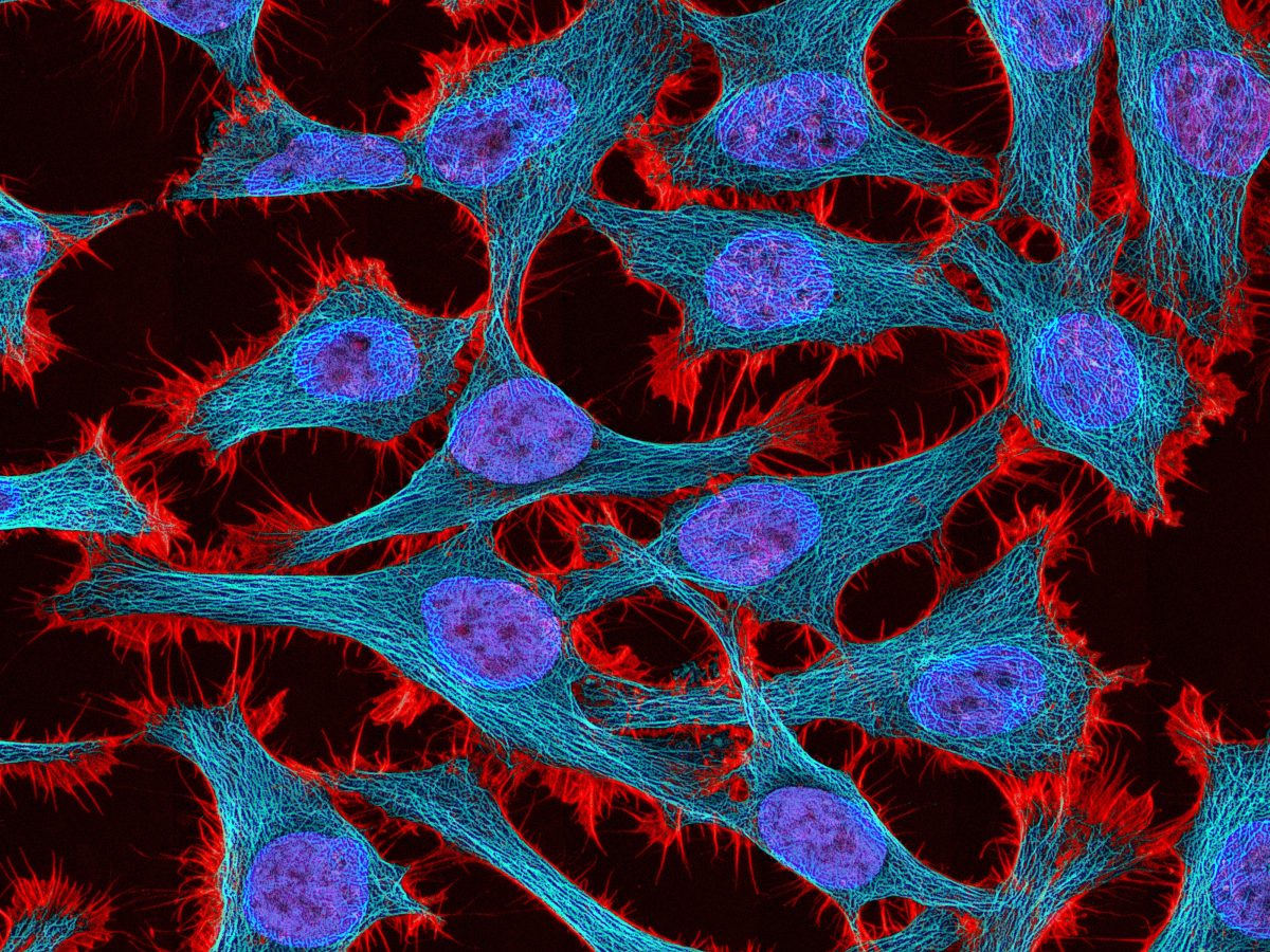 The immortal cells of Henrietta Lacks